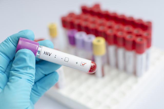 HIV sve više opštedruštveni problem